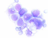 RAPID STAINING OF BLOOD SMEAR SOLUTION 3